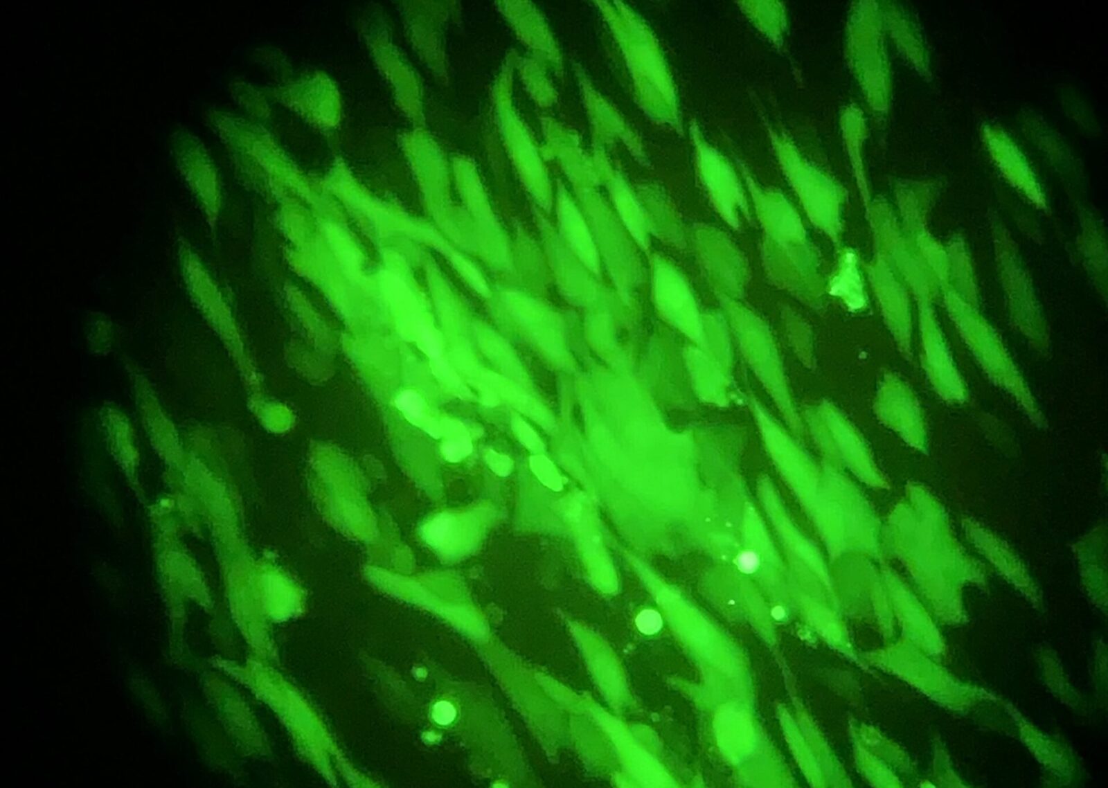 Fluorescent green plaques induced by HCMV infection
