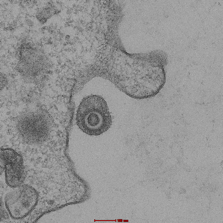 HCMV virion entering a cell by macropinocytosis